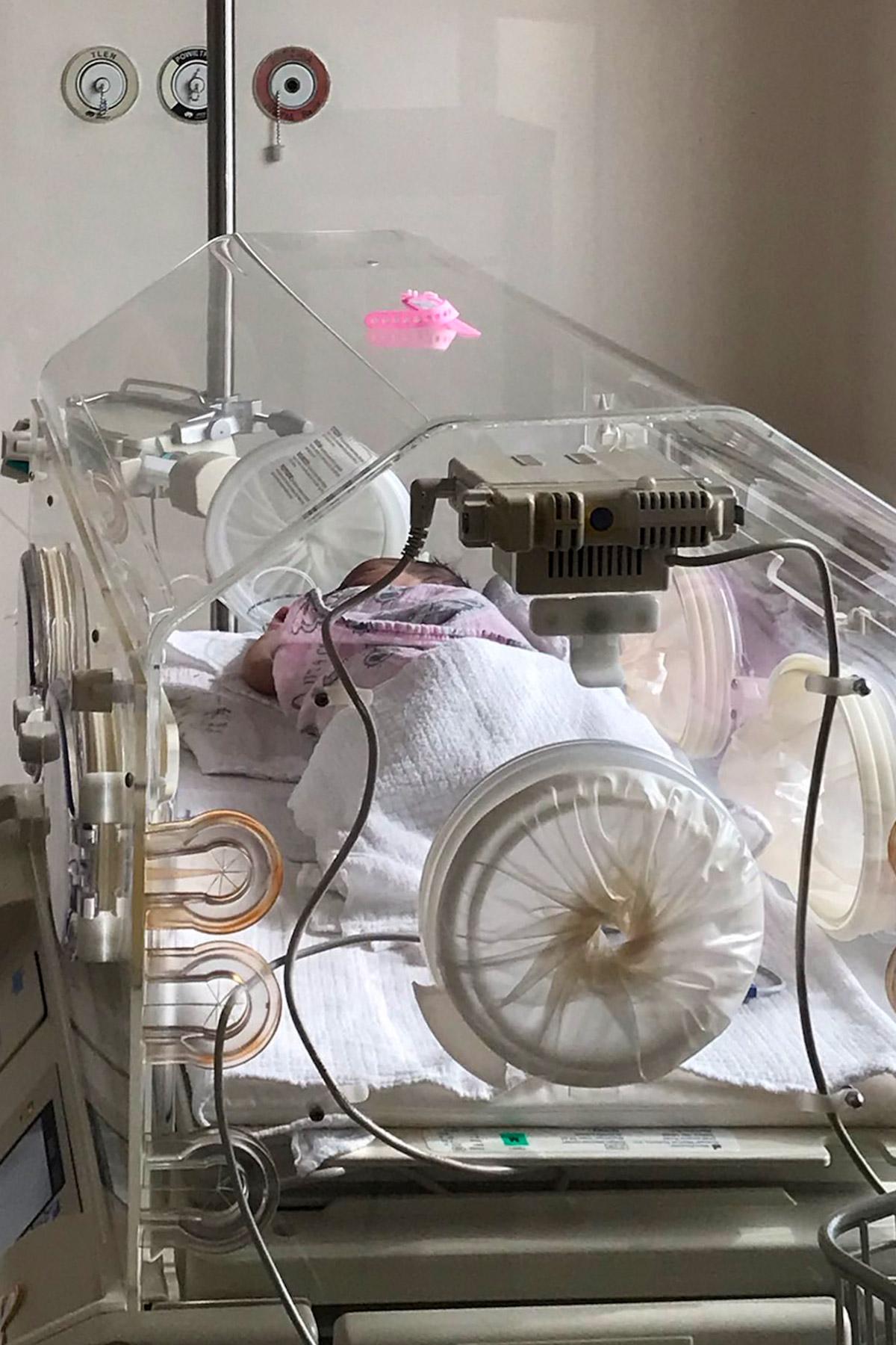 The baby was placed in an incubator and later transferred to a children’s hospital. The intervention likely saved her life. Photo: Egala